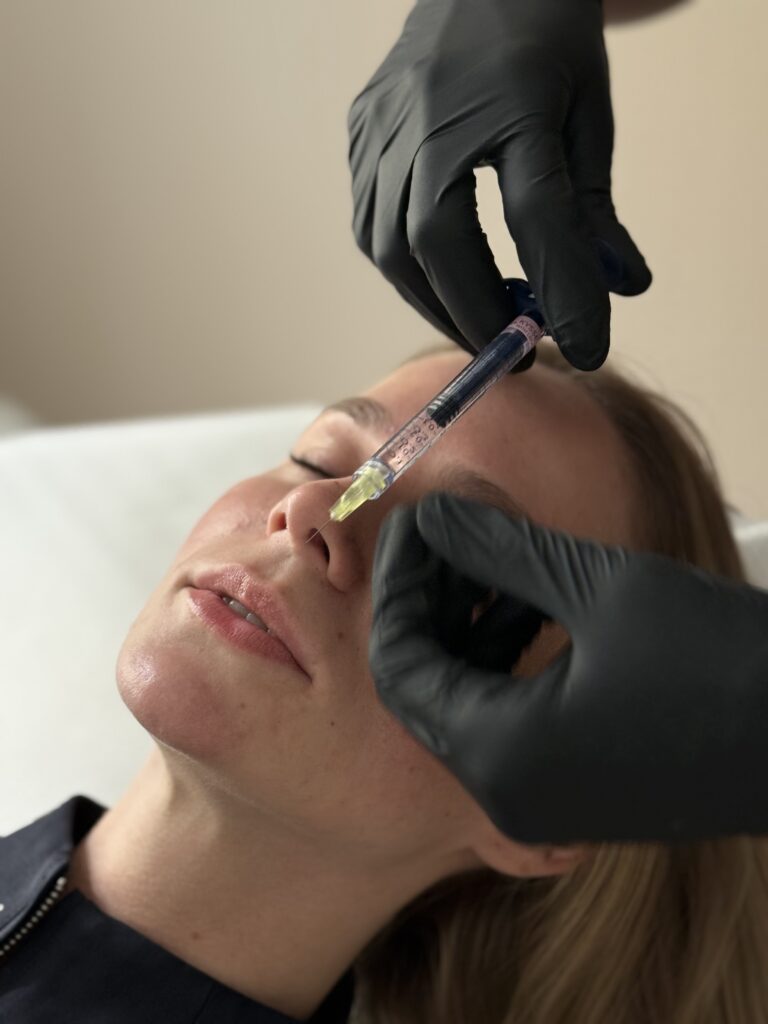Filler og botox behandling